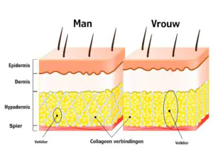 cellulite putjes in benen